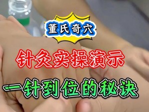 三叉三进针法视频：中医针灸绝学，快速缓解疼痛